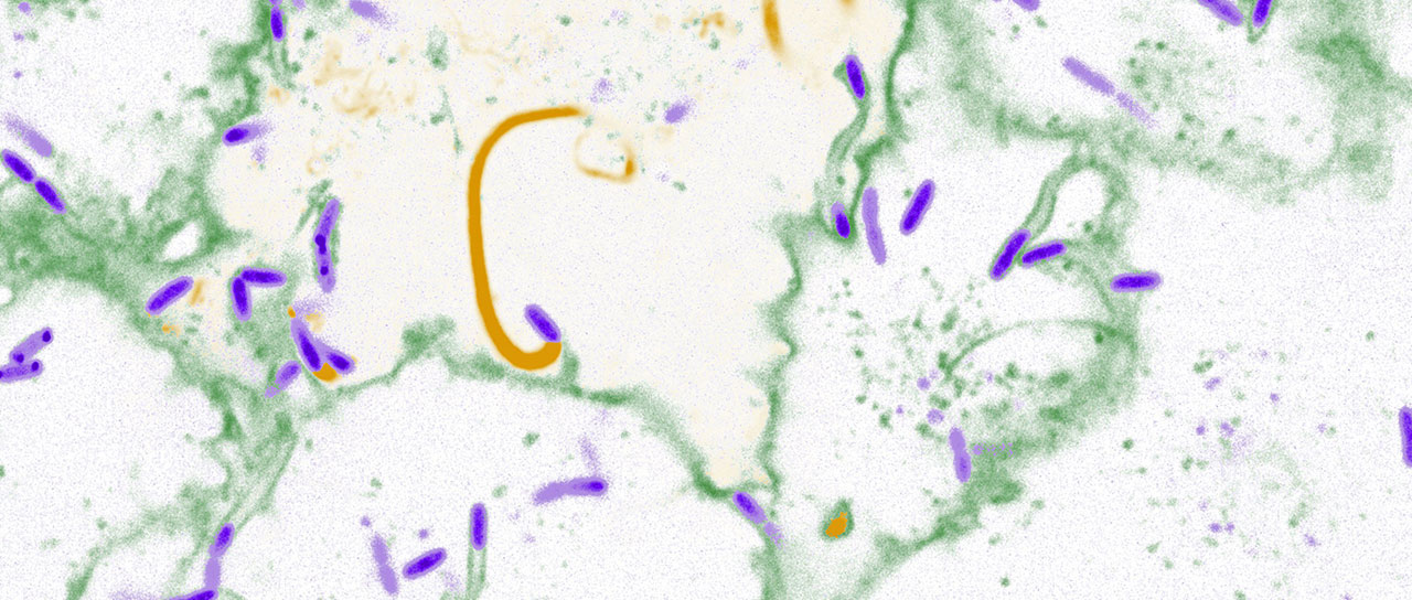 Microscopic image of Burkholderia bacteria