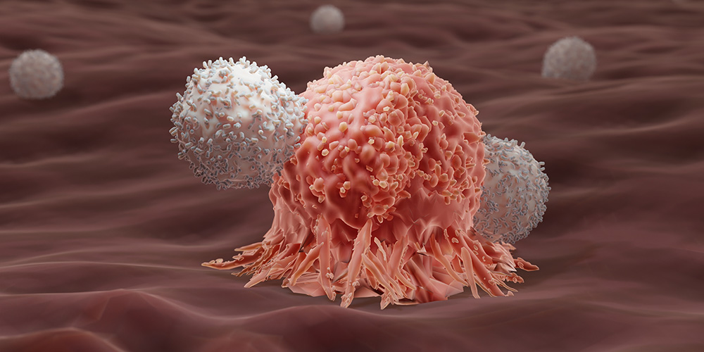 Wie Immunzellen den abnormalen Stoffwechsel von Tumoren erkennen