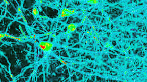 Neuronales Netzwerk