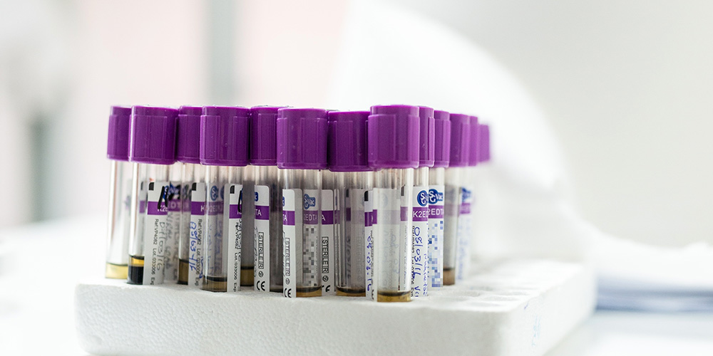 Improving HIV treatment for children and adolescents - the right way