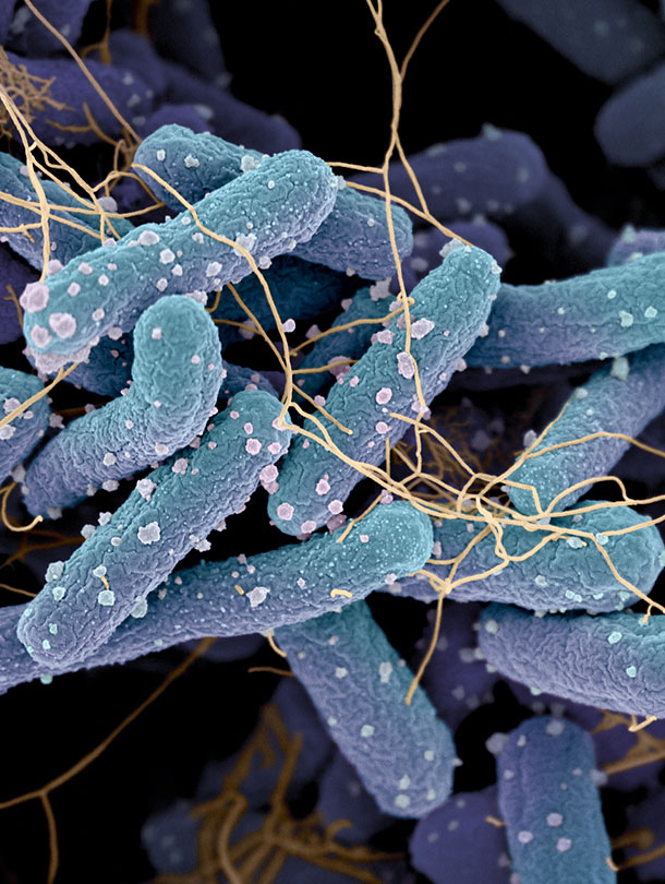 In der Regel eine friedliche Symbiose: Darmbakterium E.coli unter dem Rasterelektronenmikroskop. In der Regel eine friedliche Symbiose: Darmbakterium E.coli unter dem Rasterelektronenmikroskop.