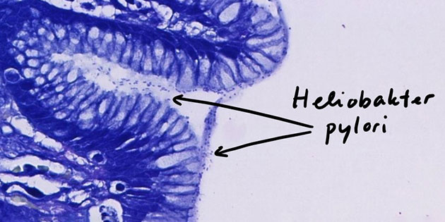 Pathologie intensiv!