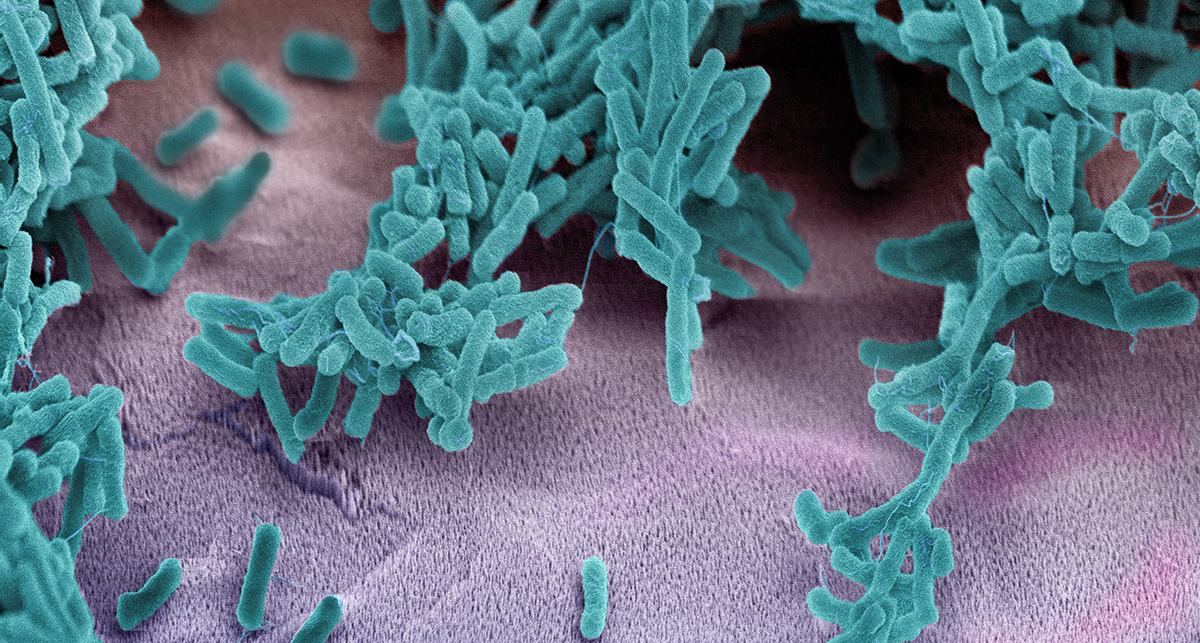 Titanoberfläche mit Nanospikes und Escherichia-coli-Bakterien.