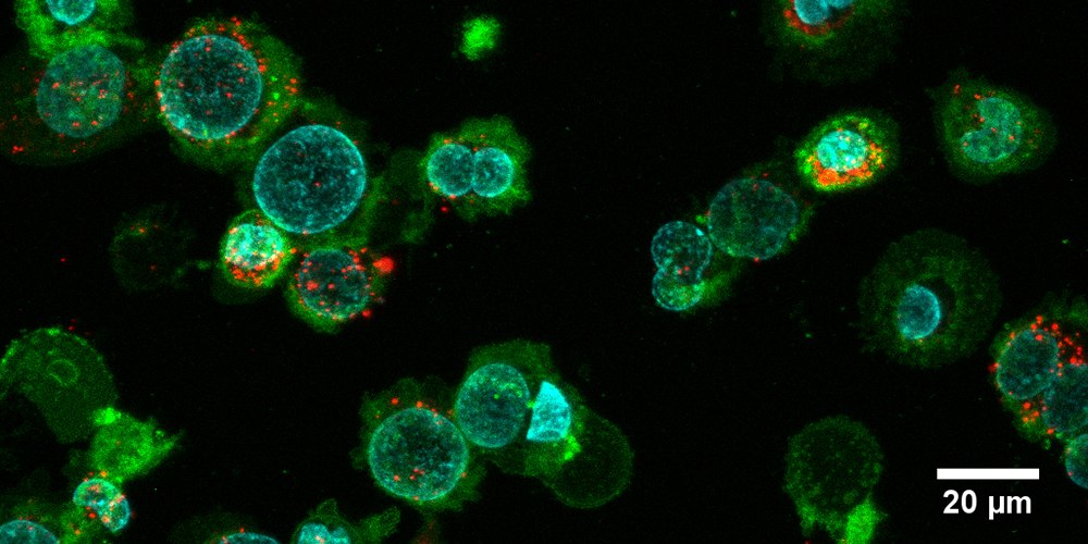 Fluoreszenzmikroskopische Aufnahme von Zellen mit Nanovesikeln