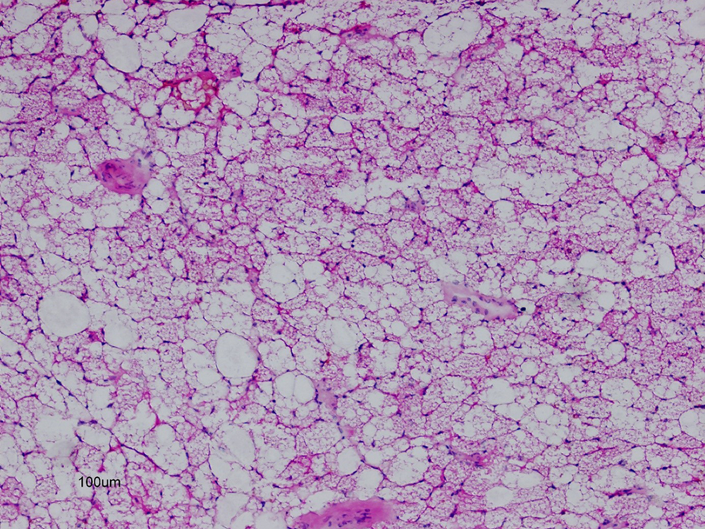 Mikroskopische Aufnahme von menschlichem Fettgewebe Mikroskopische Aufnahme von menschlichem Fettgewebe