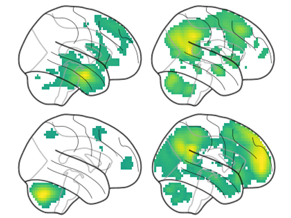 Functional networks associated with individual differences in memory performance. Functional networks associated with individual differences in memory performance.