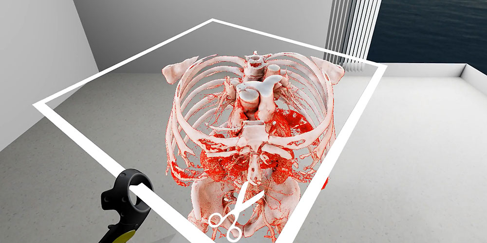 Virtual Reality in Medicine: New Opportunities for Diagnostics and Surgical Planning