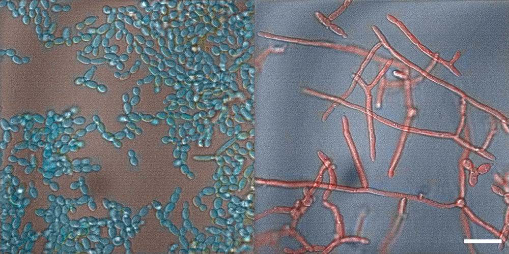 Candida albicans in seiner harmlosen (links) und seiner infektiösen (rechts) Form. Der weisse Balken entspricht 20 Mikrometern.