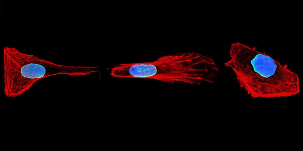 Cellular memory: The clever strategy cells use to move through narrow environments