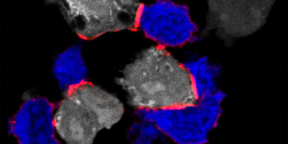 Mikroskopiebild mit fluoreszenzgefärbten Zellen: T-Zellen stehen über LFA-1 in Kontakt mit Tumorzellen, um sie zu eliminieren.