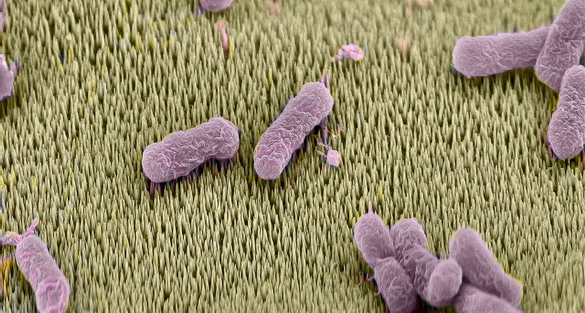 Bakterien auf Titanoberfläche mit Nanospikes.