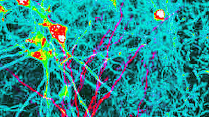Neuronales Netzwerk