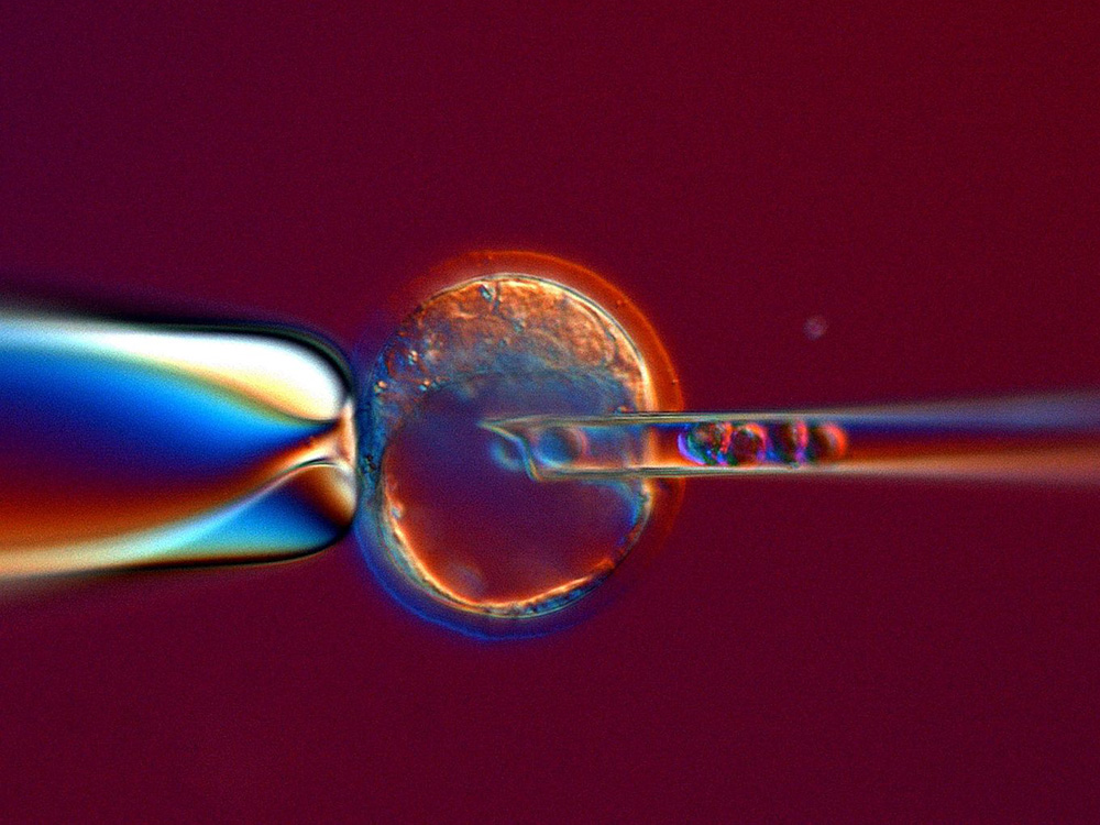 Mikroinjektion embryonaler Mäusestammzellen in einen Blastozysten-Embryo der Maus, © Universität Basel, CTM Mikroinjektion embryonaler Mäusestammzellen in einen Blastozysten-Embryo der Maus, © Universität Basel, CTM