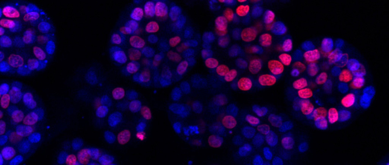 Cell clusters (organoids) under a fluorescence microscope