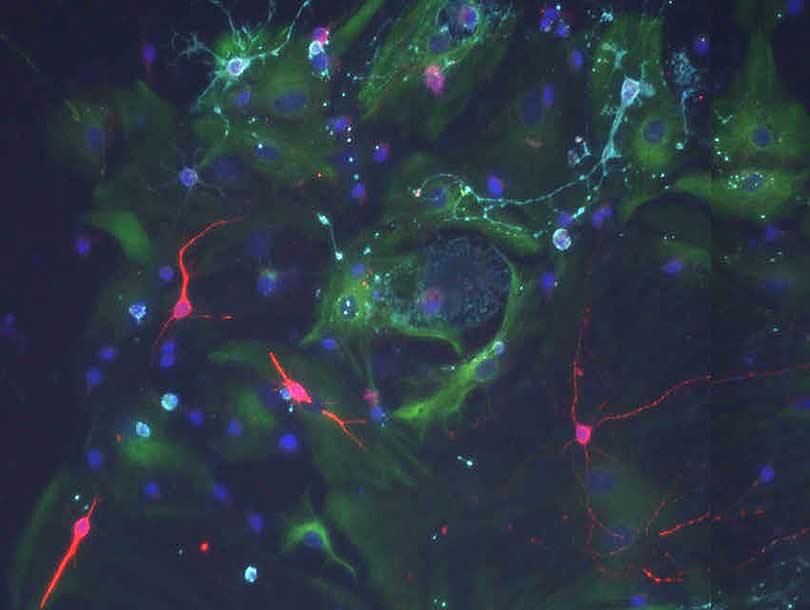 stem cells, neurons