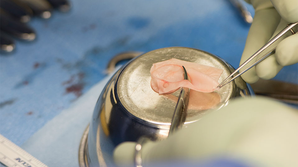 Im Operationssaal wird das Transplantat in Form und Grösse an den Knorpelschaden im Knie angepasst. (Bild: Universität Basel, Christian Flierl)