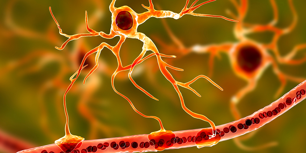 New biomarker for disease progression in multiple sclerosis