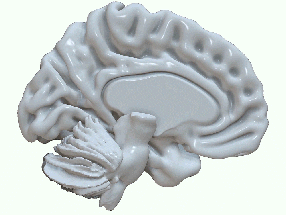 Illustration of the brain with highlighted areas