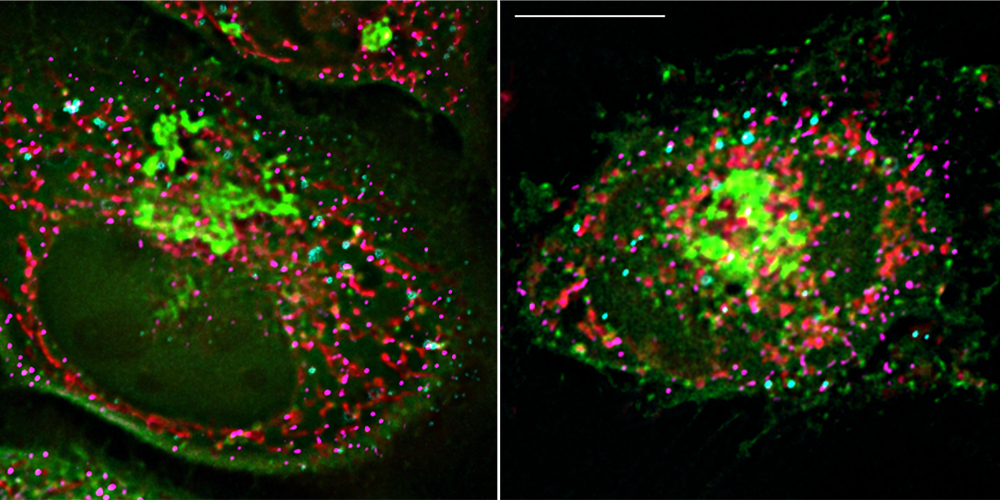 Zwei fluoreszenzmikroskopische Aufnahmen von Zellen