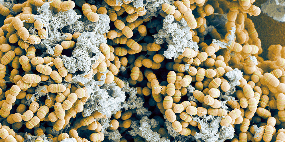 Kariesbakterien Streptococcus mutans Kariesbakterien Streptococcus mutans