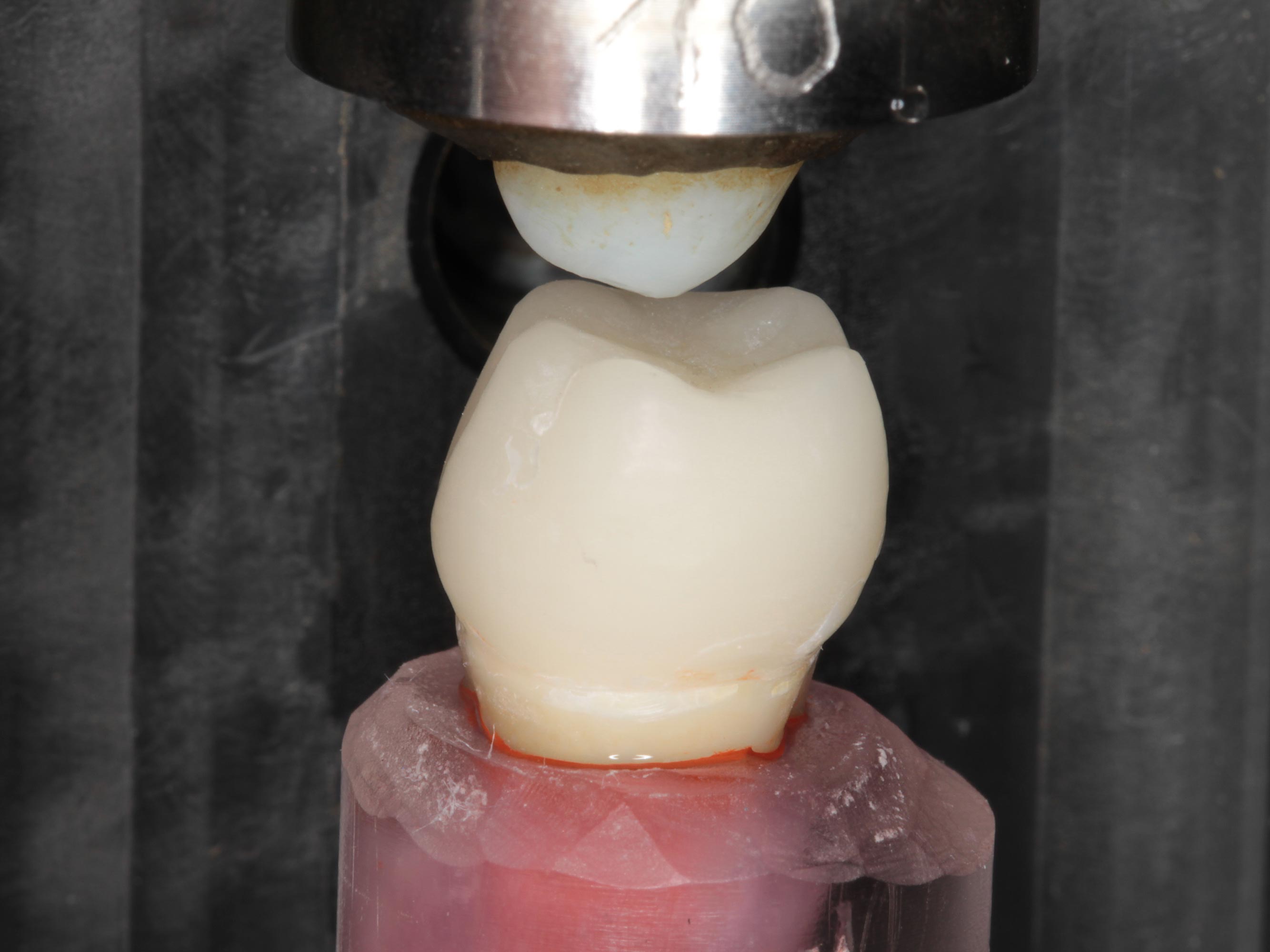 Restaurierter Zahn im Kausimulator. Für die Belastung werden natürliche<br/>Schmelzhöcker eingesetzt. Gleichzeitig wird der Zahn abwechselnd<br/>mit heissem und kaltem Wasser umspült.