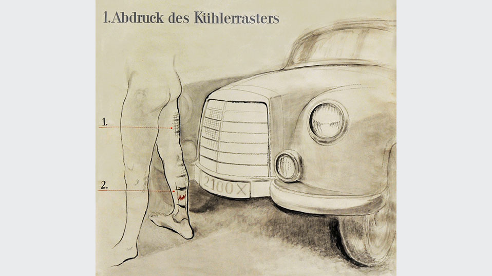 Vorlesungstafel aus Serie zum Verkehrsunfall, Abdruck des für die 50er-Jahre typischen Kühlerrasters. (© Institut für Rechtsmedizin Basel)