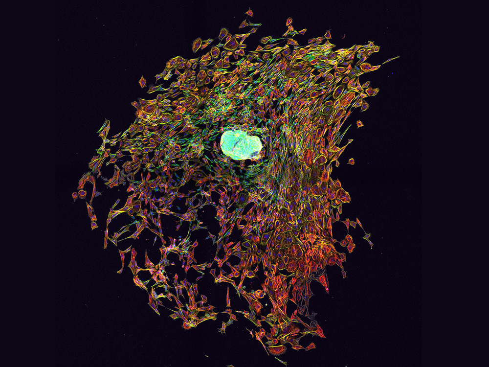 Embroyzellen, © Universität Basel, Microscopy Core Facility Embroyzellen, © Universität Basel, Microscopy Core Facility