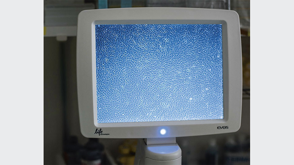 Unter dem Mikroskop erkennt man die dicht gedrängten Nasenknorpelzellen während der Vermehrungsphase. (Bild: Universität Basel, Christian Flierl)