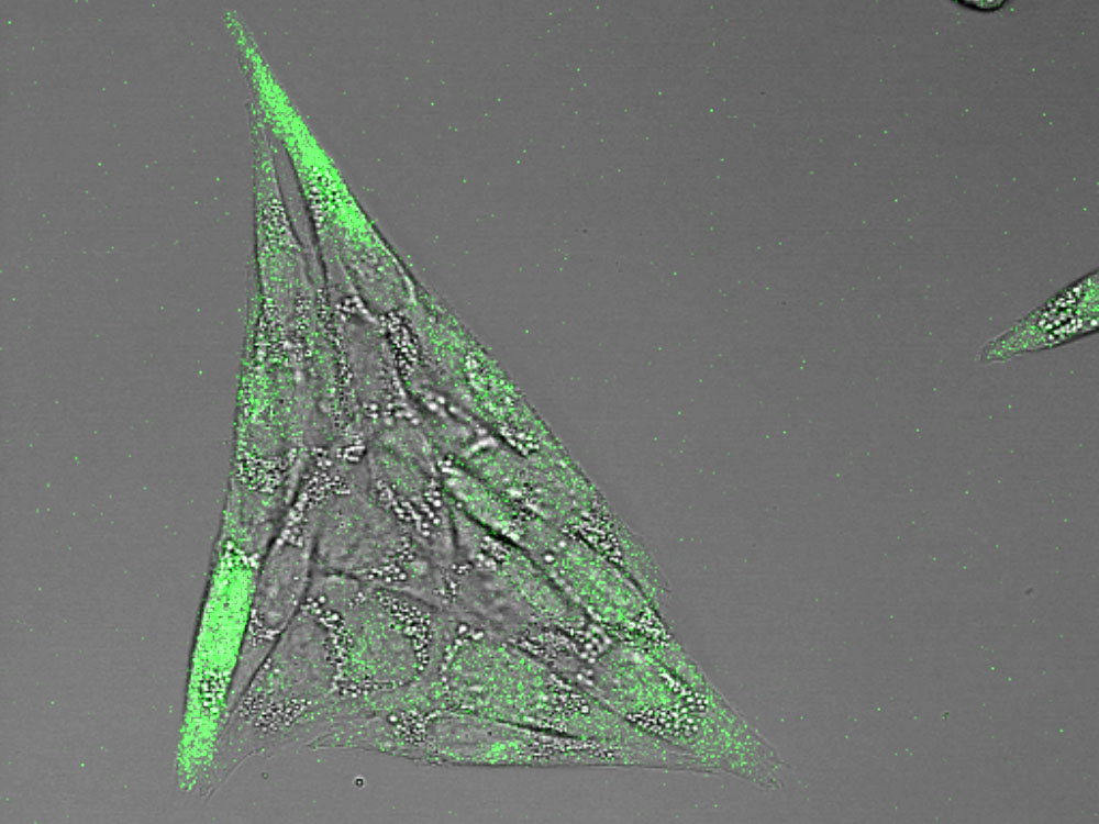 Zellen mit grüner Fluoreszenz Zellen mit grüner Fluoreszenz