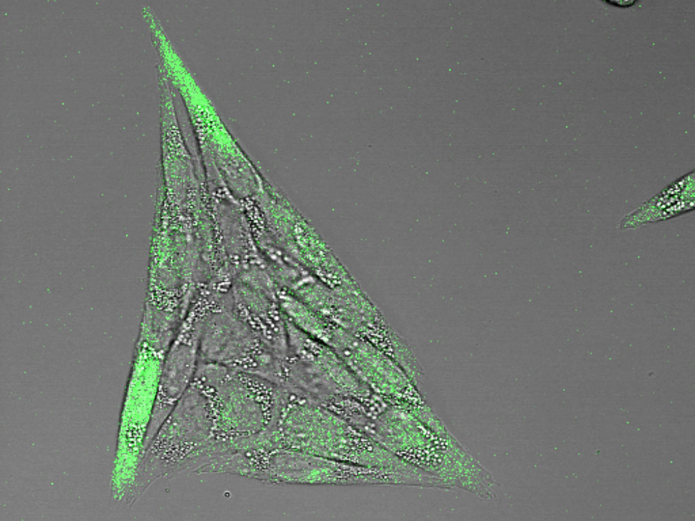 Zellen mit grüner Fluoreszenz