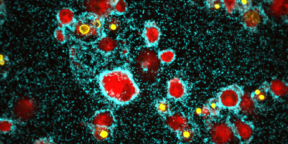 Fluorescence microscopic image of the cholera pathogen and macrophages