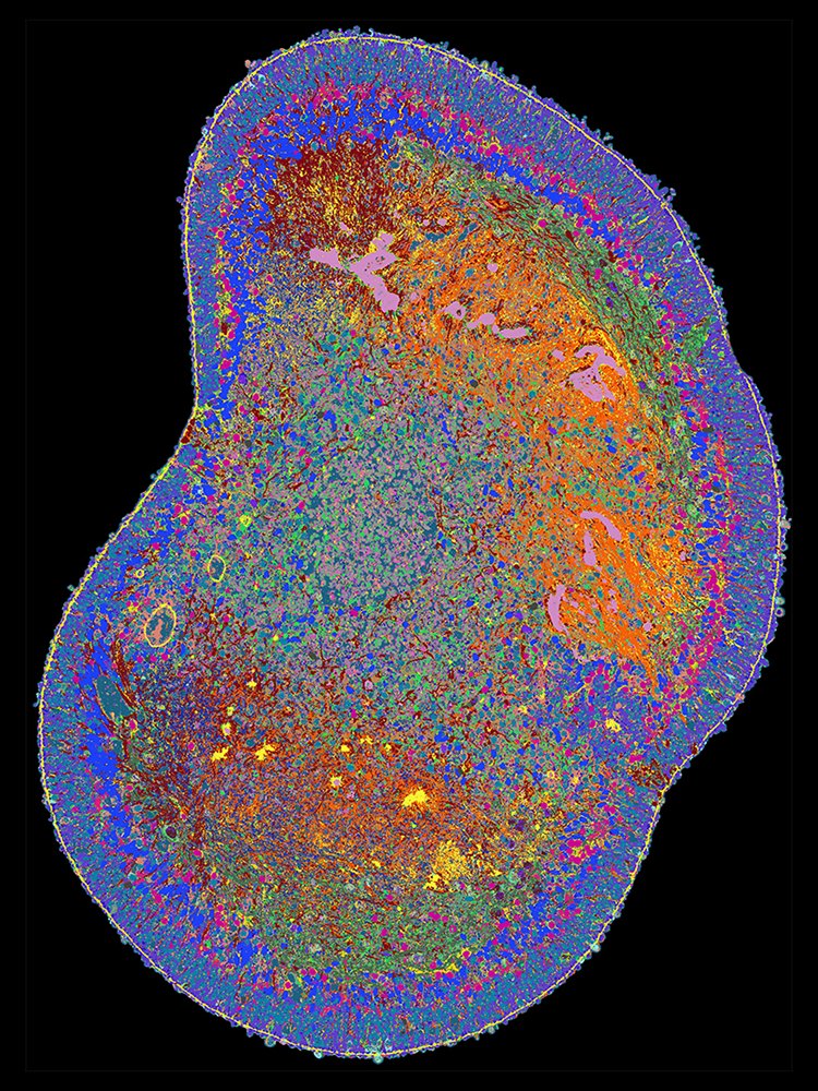 4i-Bild des Querschnitts eines Netzhaut-Organoids. 4i-Bild des Querschnitts eines Netzhaut-Organoids.
