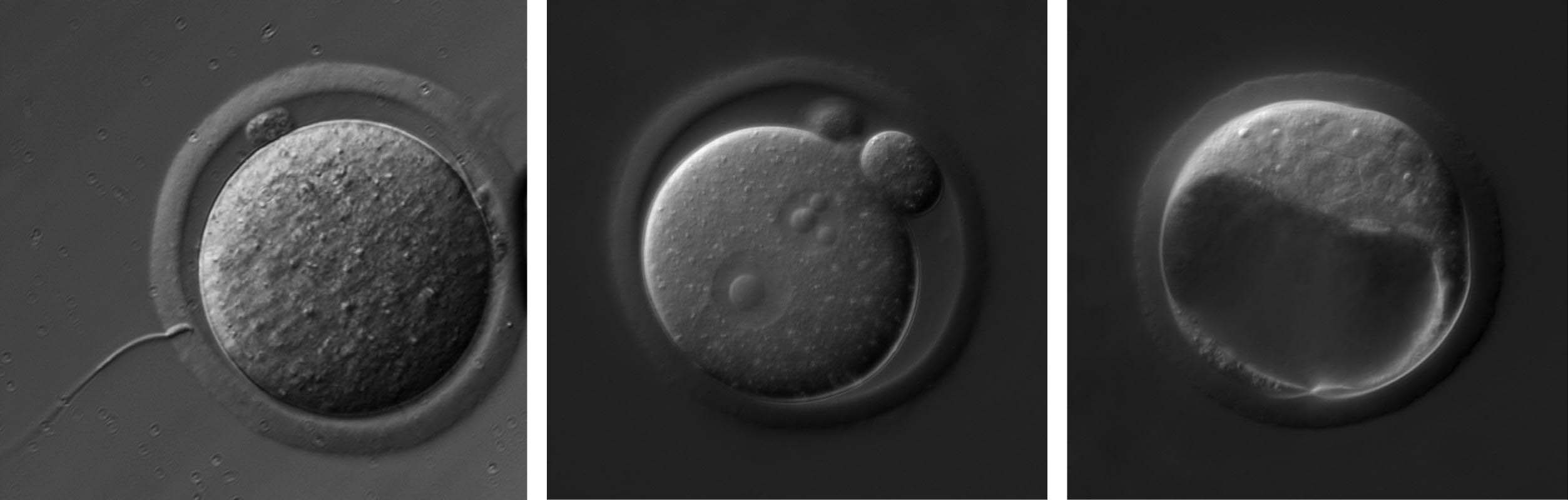 Entwicklungsstadien: Spermium und Ei (links), Zygote (mitte) und Blastozyste (rechts) bei der Maus.