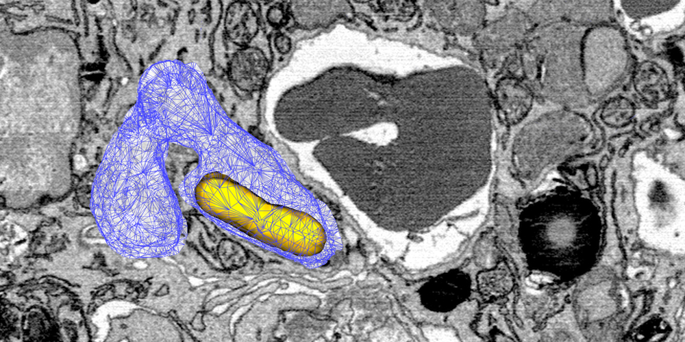 Survival trick: Pathogen taps iron source in immune cells
