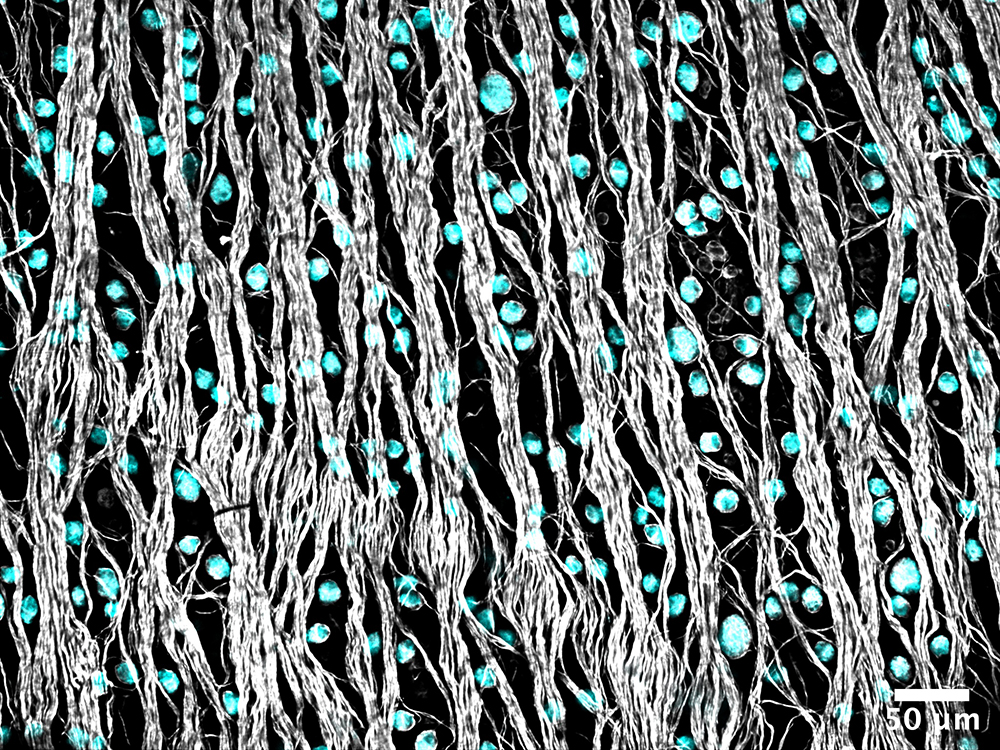 cell bodies between strands of axons cell bodies between strands of axons