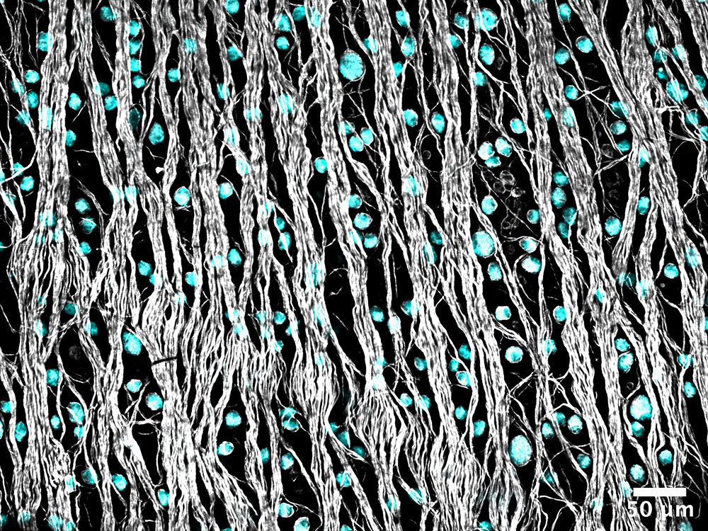 cell bodies between strands of axons