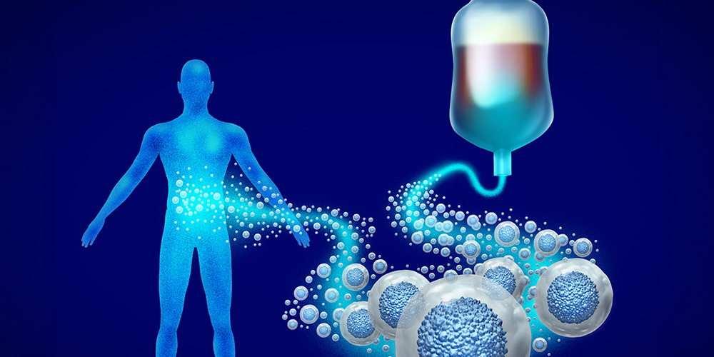 Physical exercise may improve stem cell donation