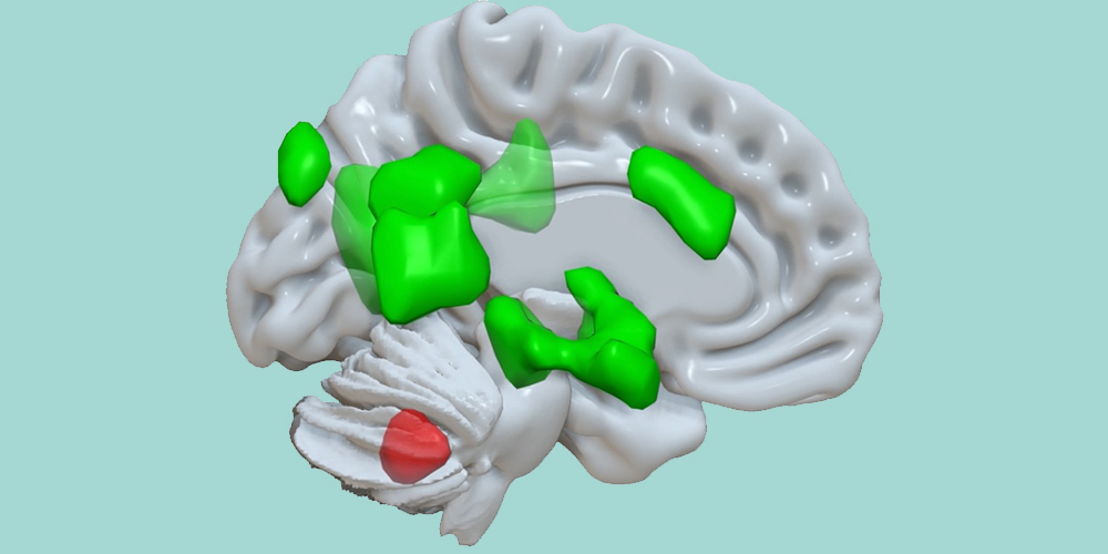 Illustration des Gehirns mit hervorgehobenen Bereichen