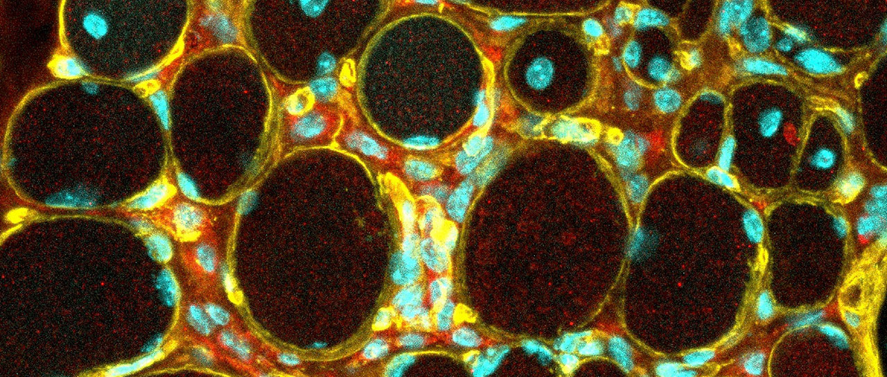 Fluorescence microscopy image of round cell structures.