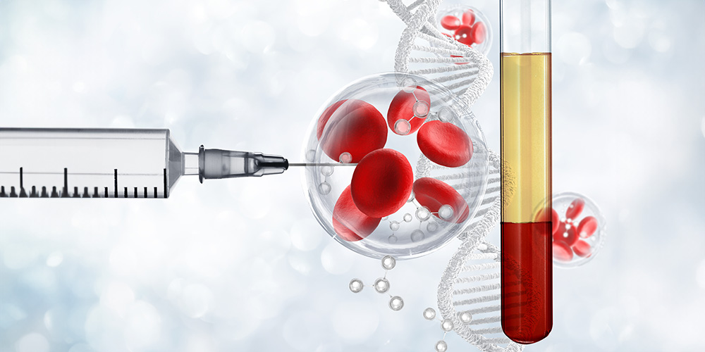 Inflammatory bowel disease after a stem cell transplant