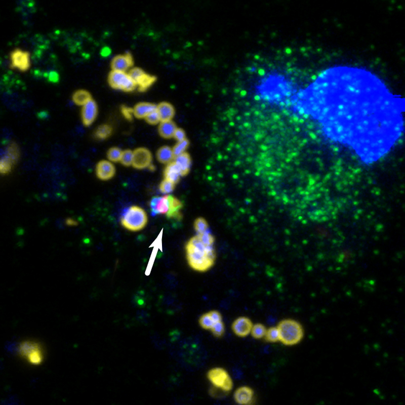 Guanylat-bindende Proteine (grün) lagern sich an Francisella novicida Bakterien (gelb) an und ermöglichen deren Erkennung durch den Inflammasom-Komplex (rot).