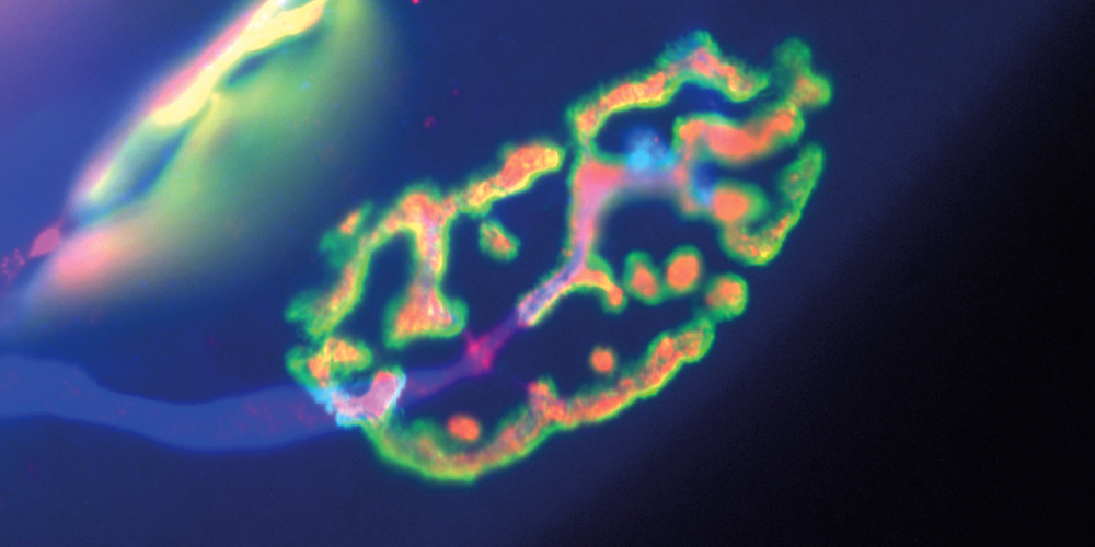 How neuromuscular connections are maintained after nerve lesions