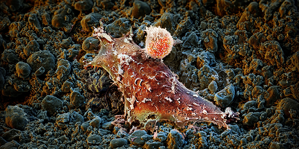Stronger together: a new fusion protein boosts cancer immunotherapy 