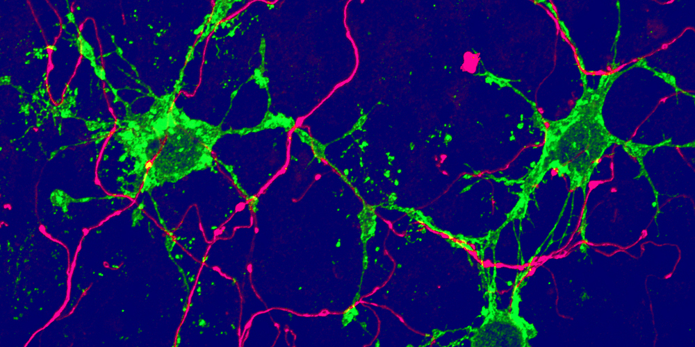 Fluorescent microscopic image of glia cells and nerve cells