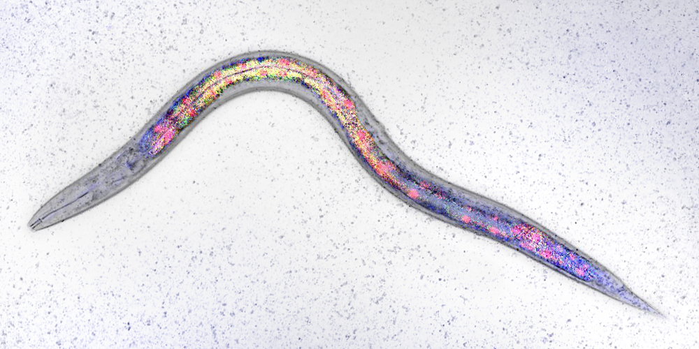 Cholesterol disrupts lipid metabolism in the cell