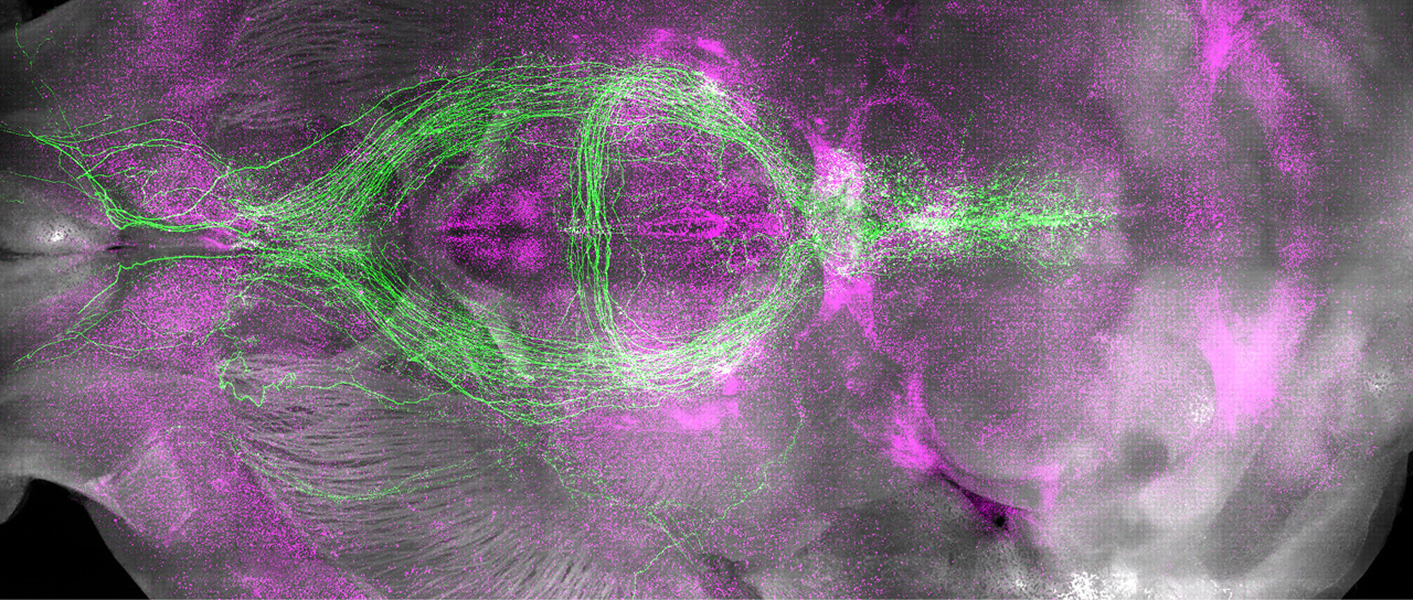 fluorescent micsroscopic image of a mouse brain with colorized neurons