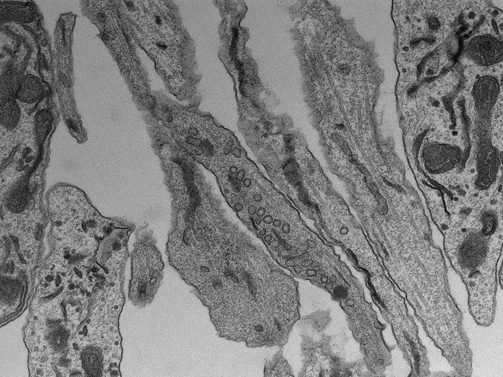 Transmissionselektronenmikroskopie von Mikrogewebe des menschlichen Hirns, © Universität Basel, BioEM Lab 