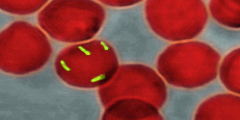 Mikroskopische Aufnahme: Rote Blutkörperchen mit Bakterien im Inneren