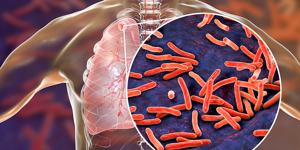 New test shows which antibiotics actually work