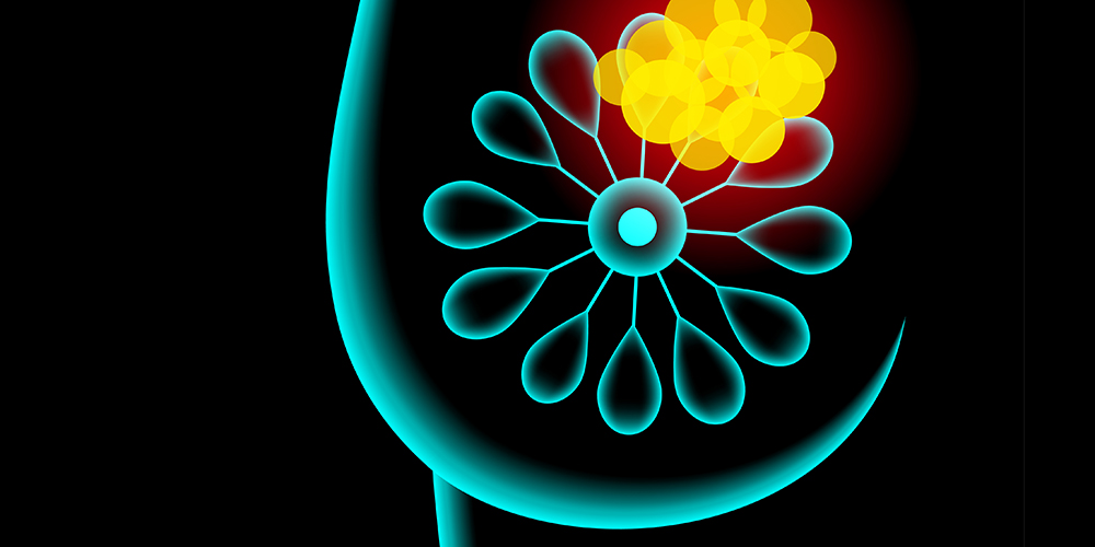 Researchers turn cancer cells into less harmful cell types